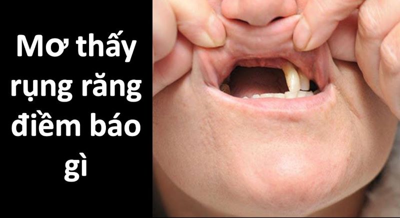 Mơ thấy gãy răng đánh con gì may mắn!