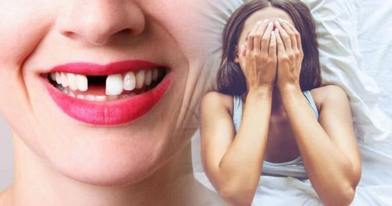 Giải mã giấc mơ thấy gãy răng - rụng răng cảnh báo tai họa ngập đầu